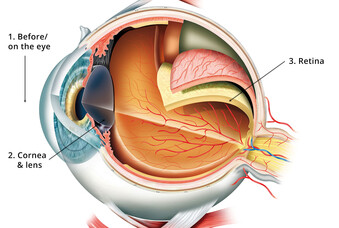 Ophthalmology Ophthalmology
